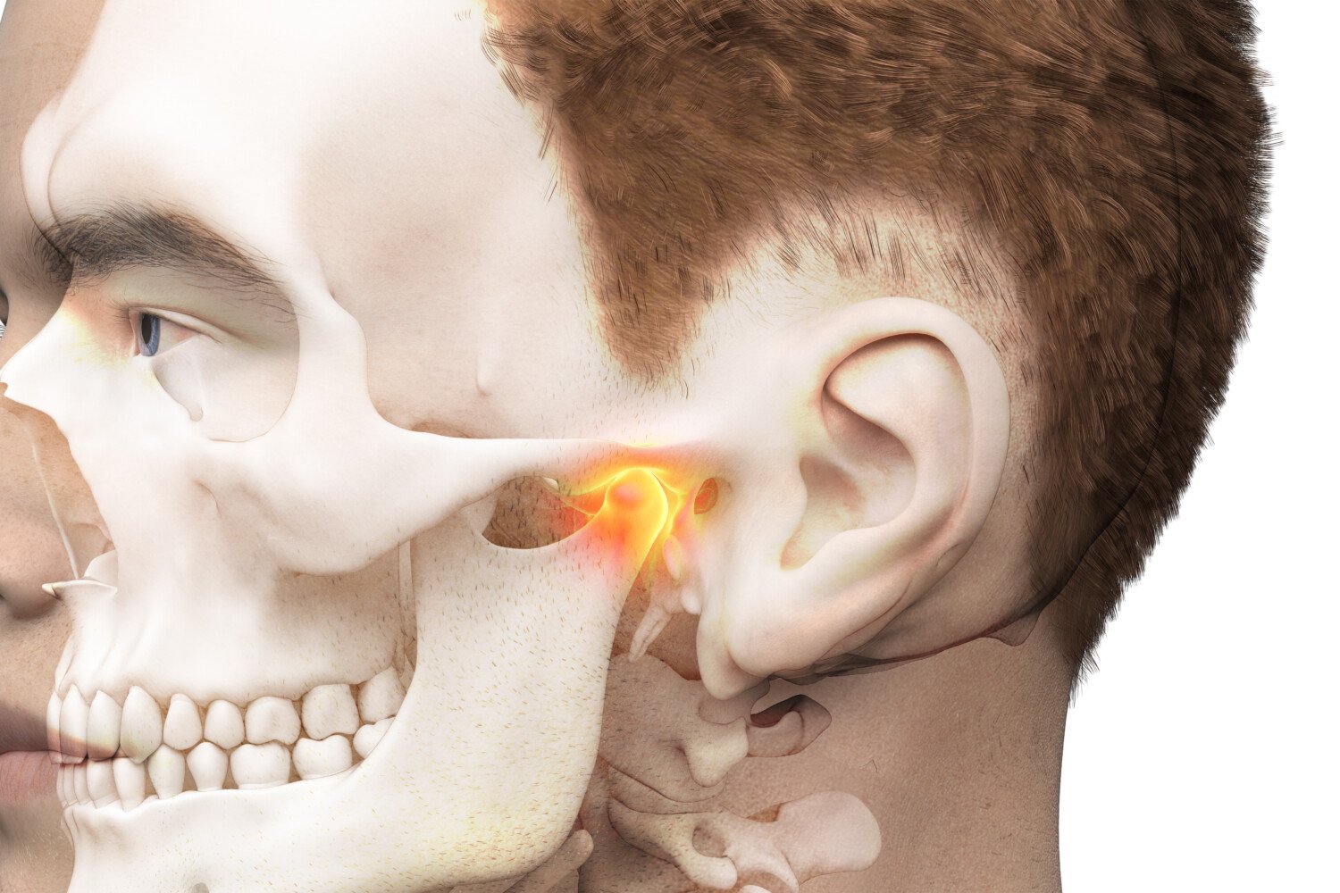 3d rendered illustration of a painful temporomandibular joint